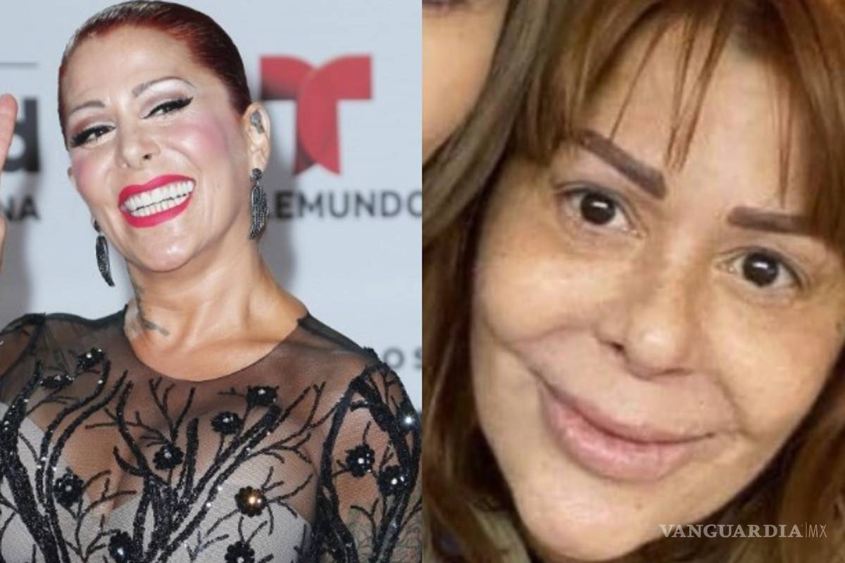 No solo es la Guzmán; estas celebridades quedaron peor con sus cirugías