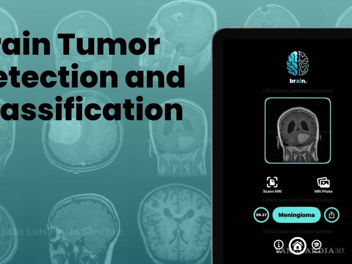 $!La aplicación “Brain” desarrollada por Juan Luis Flores Sánchez, utiliza inteligencia artificial para detectar tumores cerebrales.