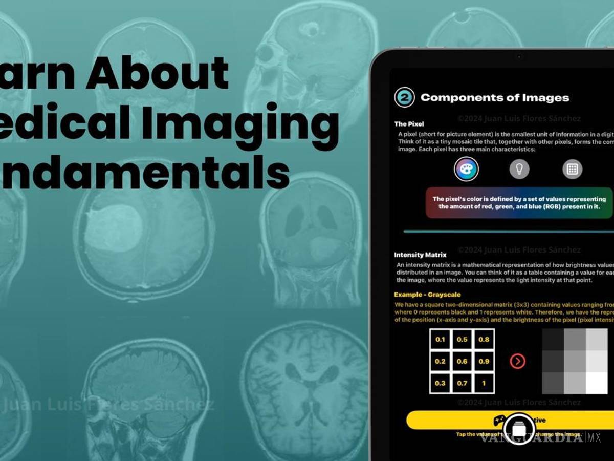 $!Imagen de la interfaz de la aplicación “Brain” en un dispositivo Apple, mostrando su capacidad para analizar imágenes médicas.