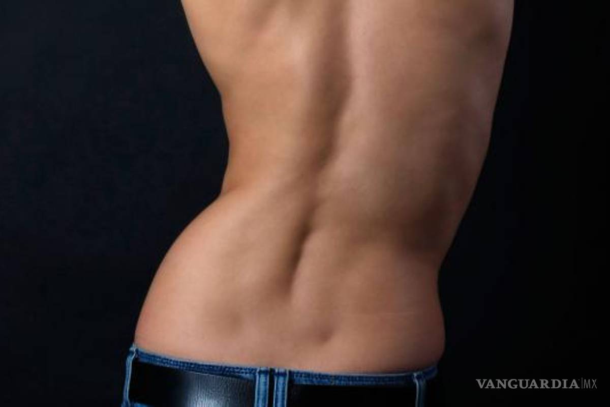 Atenderá DIF Saltillo a personas con escoliosis