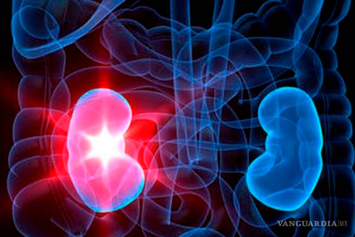 Al año en México, 40 mil nuevos casos de enfermedad renal crónica