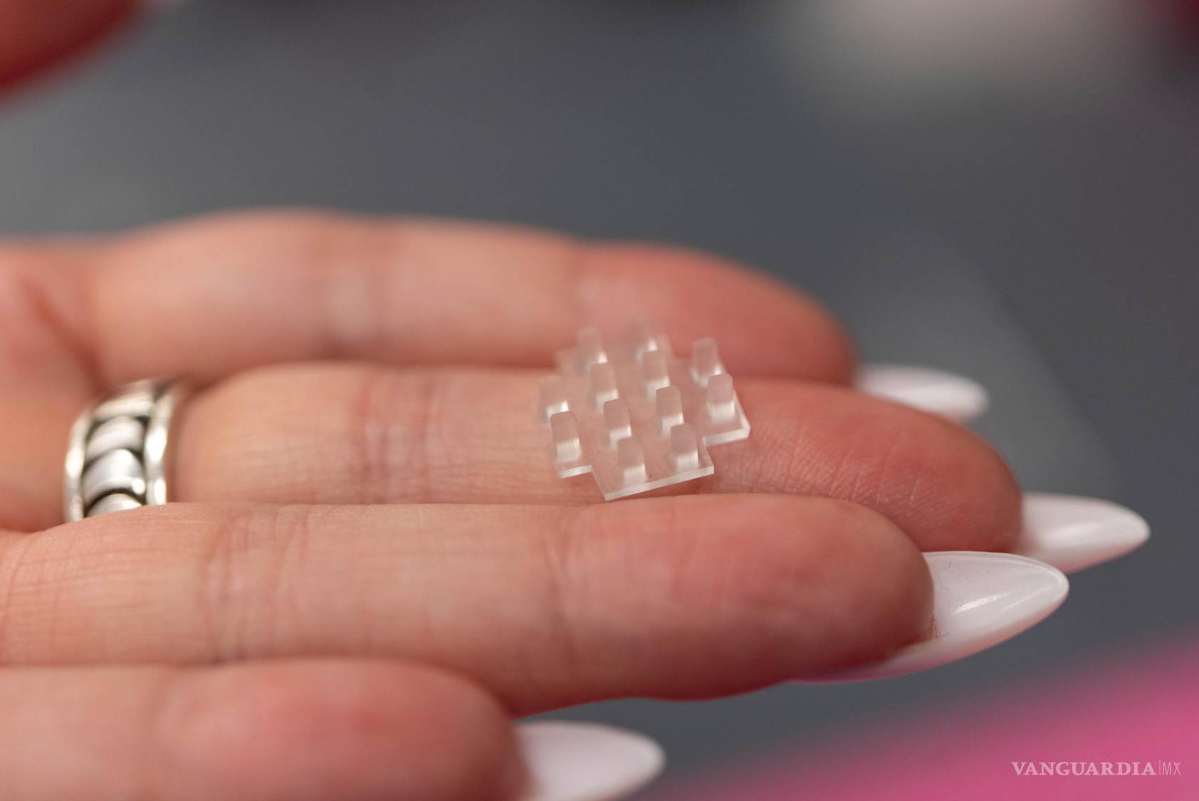 $!El tamaño y la forma de ‘parche vivo’ para la cicatrización de heridas pueden adaptarse a zona de la lesión.
