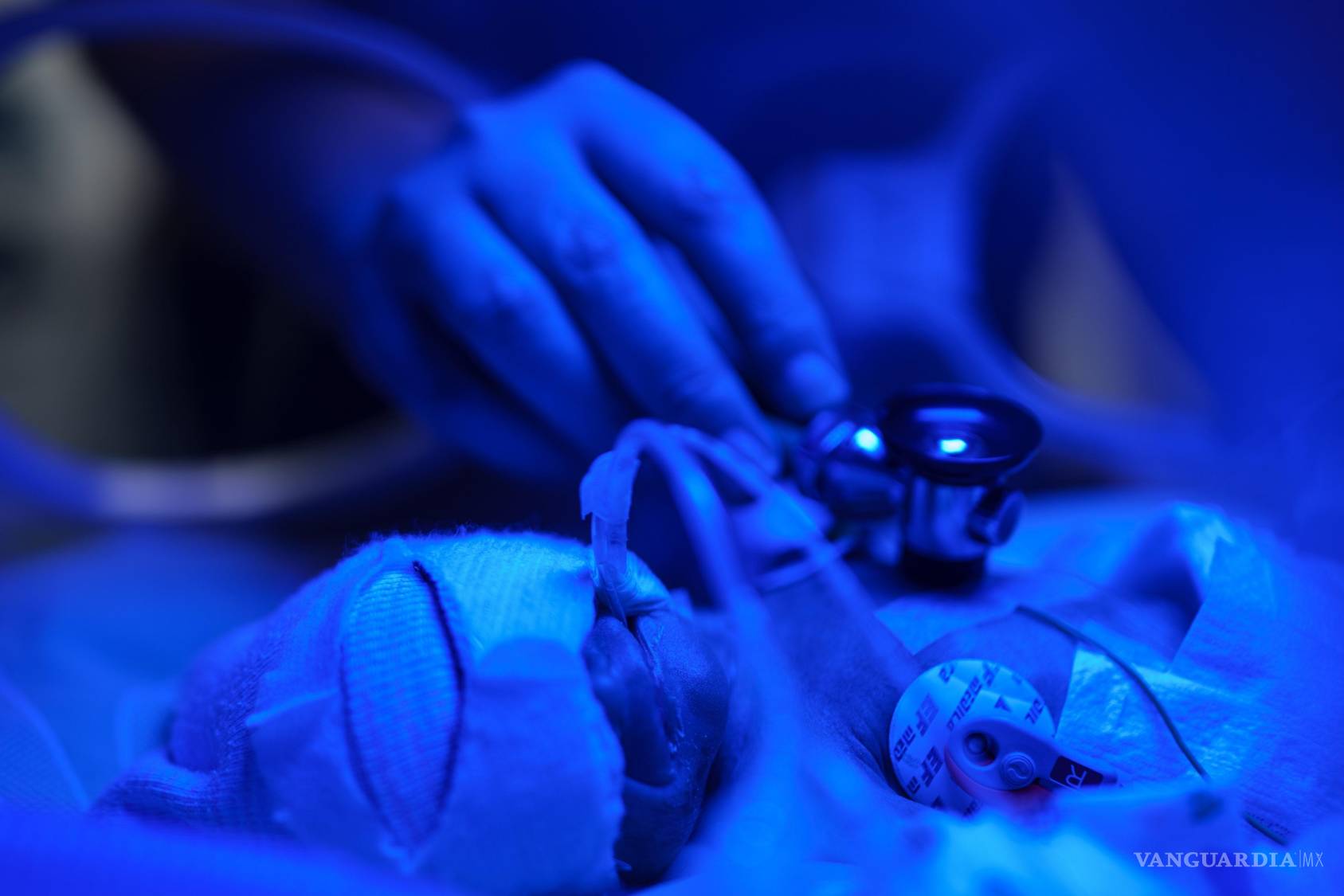 $!El Dr. Andrii Lobanov escucha los latidos del corazón de un bebé prematuro con un estetoscopio dentro de una incubador en el centro perinatal regional de Zaporiyia.