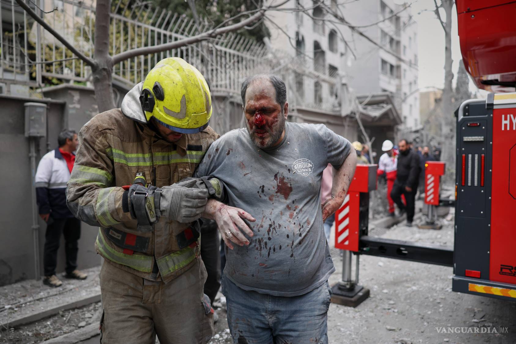 $!Un paramédico atiende a un hombre herido tras un ataque aéreo contra un edificio residencial en el marco de la campaña militar estadounidense-israelí en Teherán.