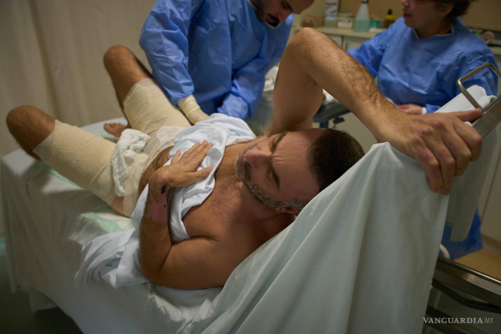 $!Mohammad Qubaisi, de 53 años, que sufrió quemaduras en un ataque aéreo israelí en el sur de Líbano, durante una cirugía del doctor Mohammed Ziara.