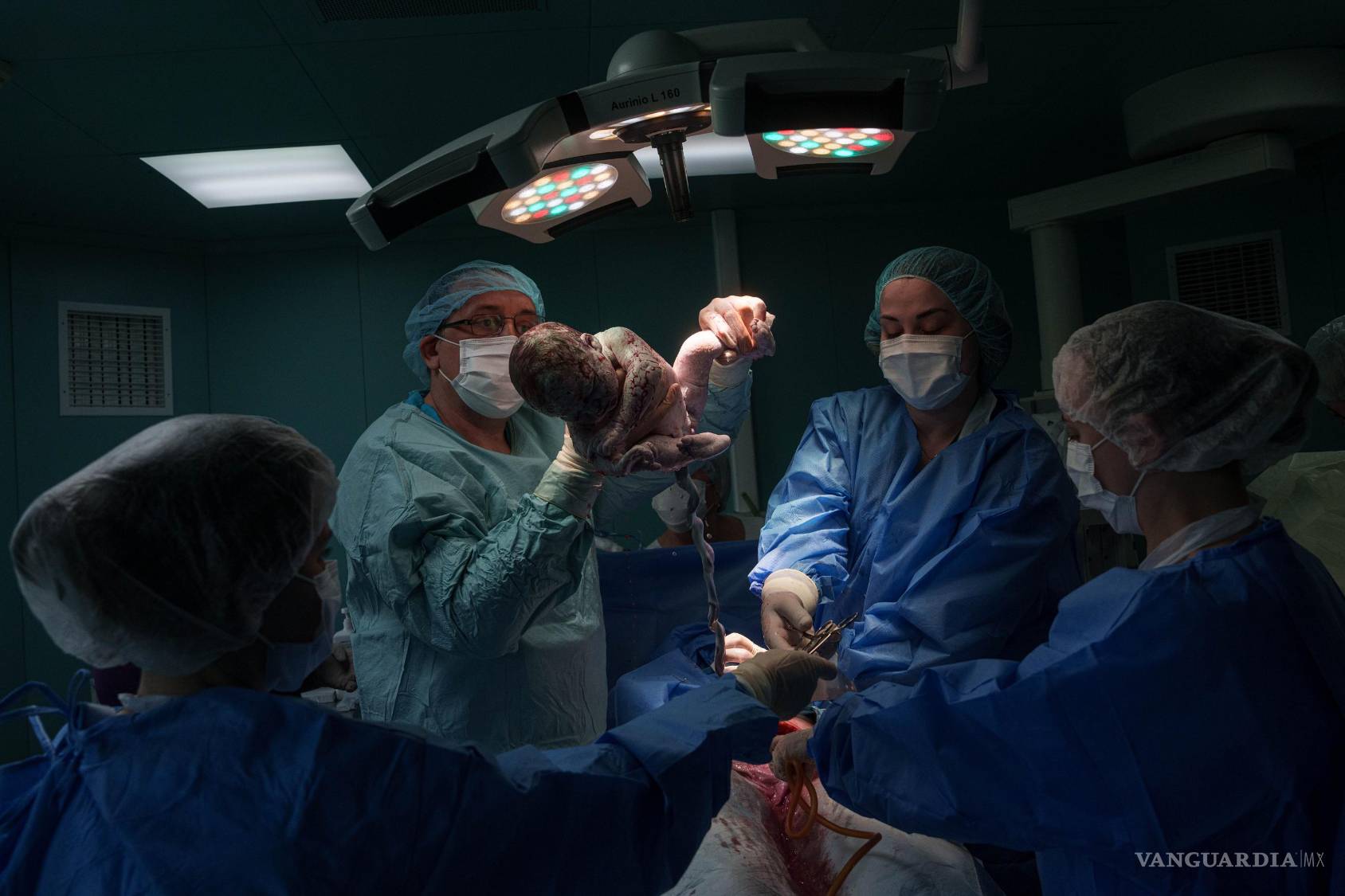 $!Un médico sostiene en brazos a la recién nacida Diana tras practicarle una cesárea a su madre, Olha Karpenko, en el centro perinatal regional de Zaporiyia, Ucrania.