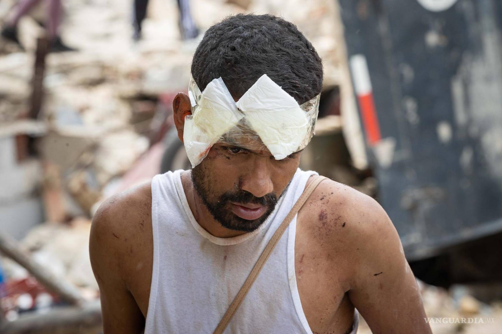 $!Una persona herida camina entre los escombros de edificios derrumbados este jueves, en La Guaira, Venezuela.