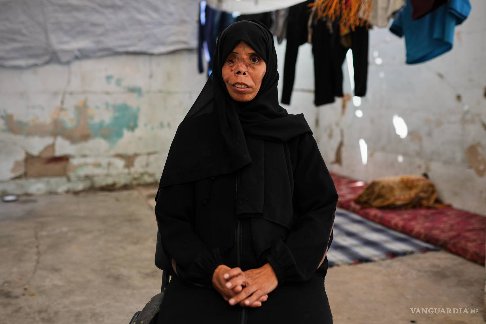 $!Najwa Abu Eita, que resultó herida durante un bombardeo israelí y que perdió a su hija de 7 años en 2024 en su tienda en Nuseirat, en el centro de Gaza.