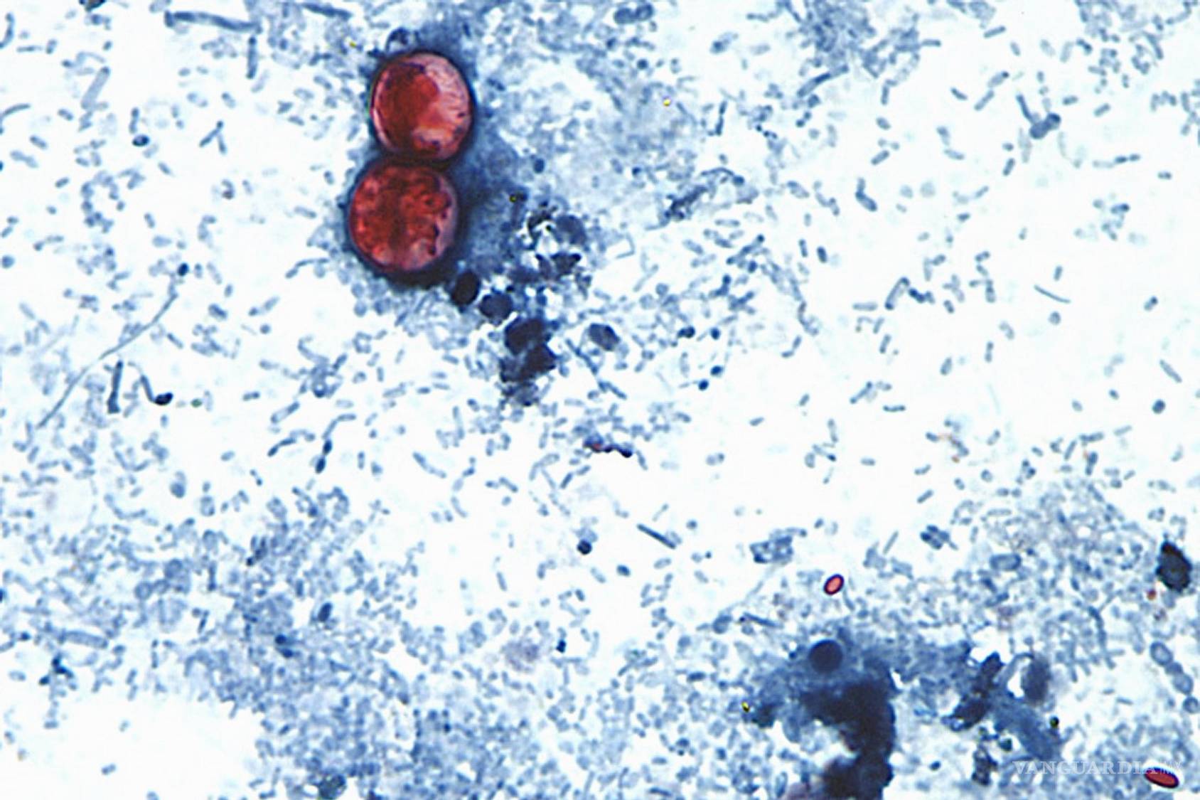 $!En esta imagen tomada con un microscopio se muestran ooquistes de Cyclospora cayetanensis en una muestra de excremento.