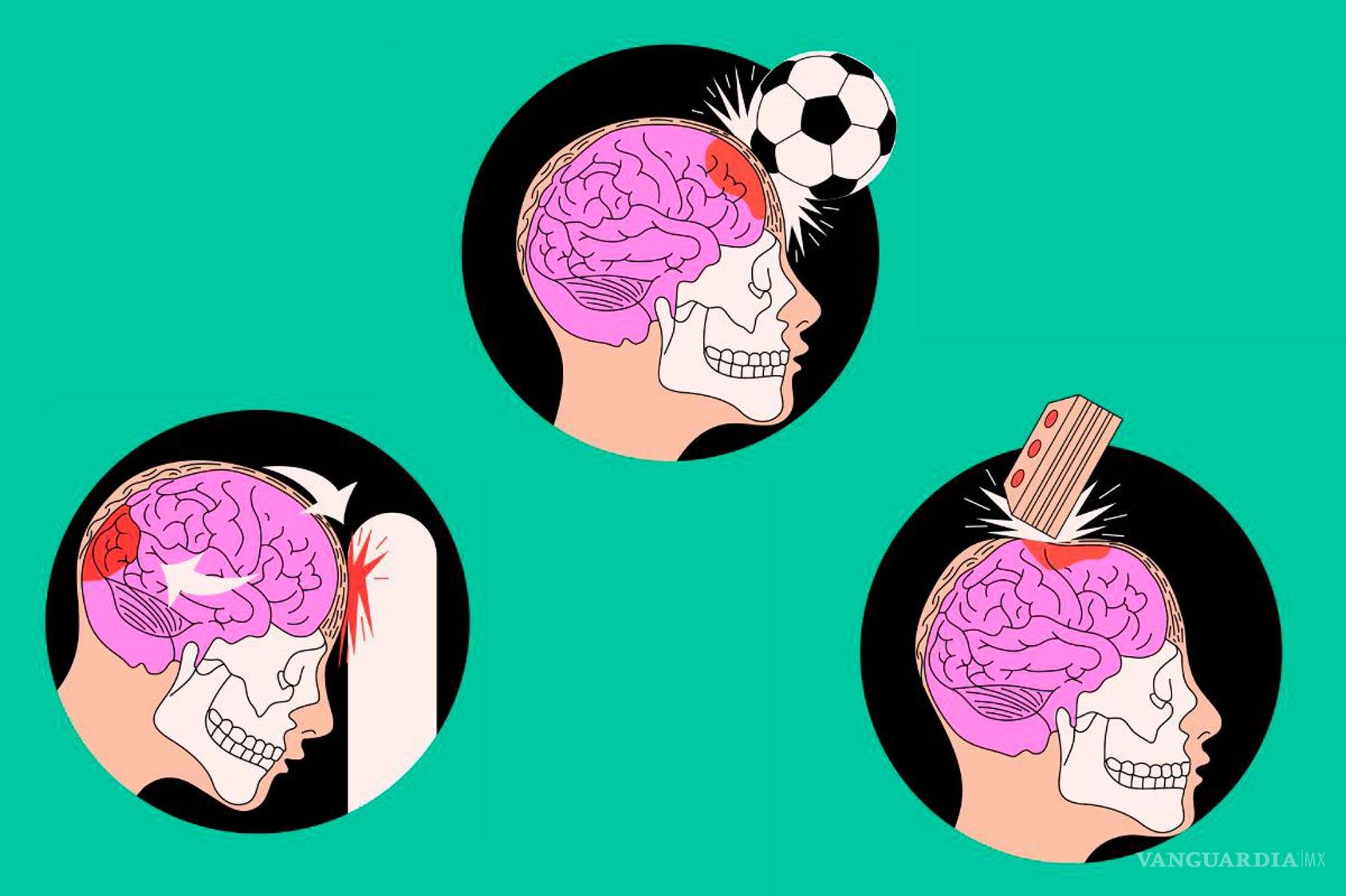 $!No necesariamente tienes que perder el conocimiento, muchas veces los síntomas aparecen semanas después.