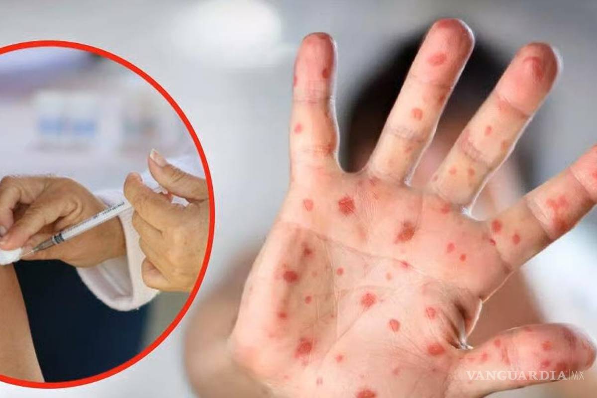 Contienen brote de sarampión en Piedras Negras y levantan cerco sanitario