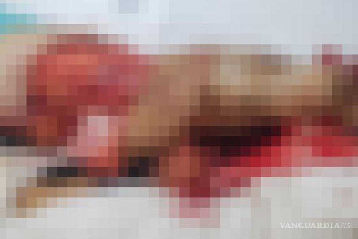 $!Familiares de Aglaé ¨N¨ esperan avances mientras la mujer permanece grave en el hospital.