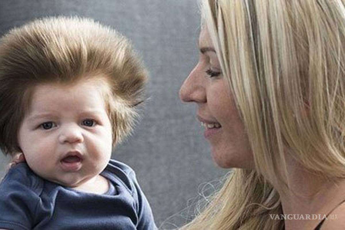 $!¿Por qué algunos bebés nacen calvos y otros con cabello?