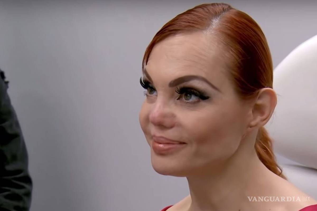 Así reaccionó Carmen Campuzano al saber que su nariz no tiene arreglo