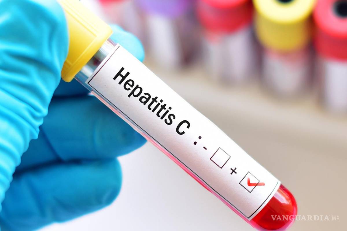 Destaca Coahuila en lucha contra la Hepatitis C