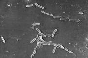 Esta imagen de microscopio electrónico proporcionada por los Centros para el Control y la Prevención de Enfermedades de EU muestra la bacteria Pseudomonas aeruginosa. AP/Janice Haney Carr/CDC