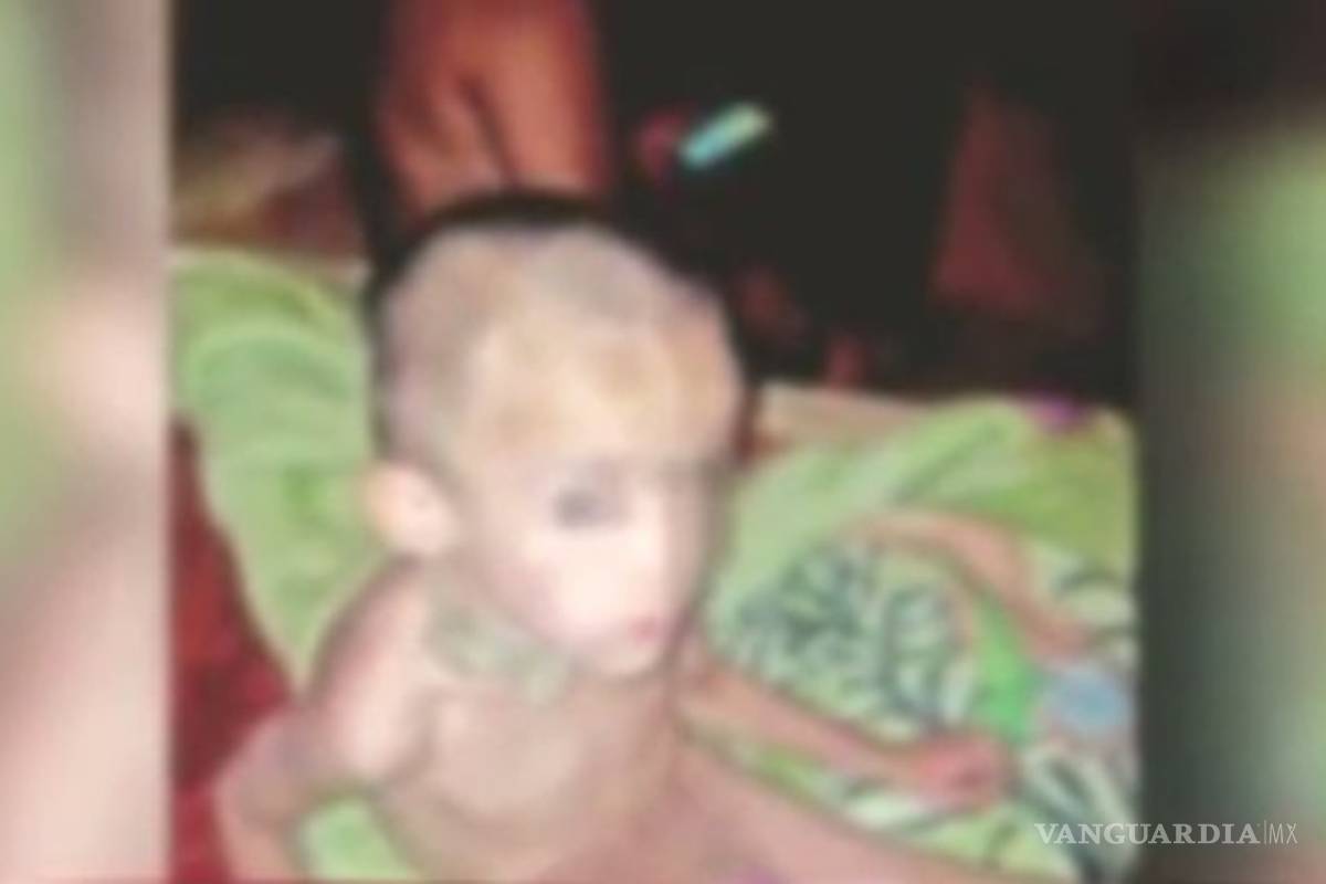 Antony, menor que sufría de tortura, se recupera en hospital; autoridades confirman que nació en EU