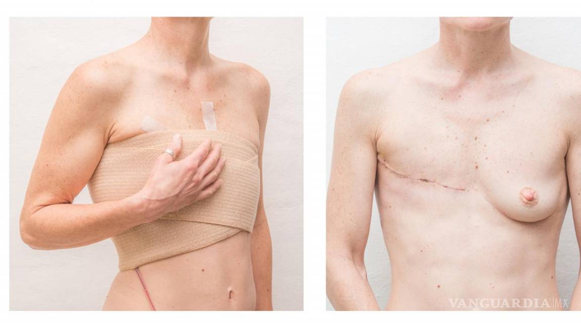 $!Obra de Ana Grúdine sobre el cáncer de mama.