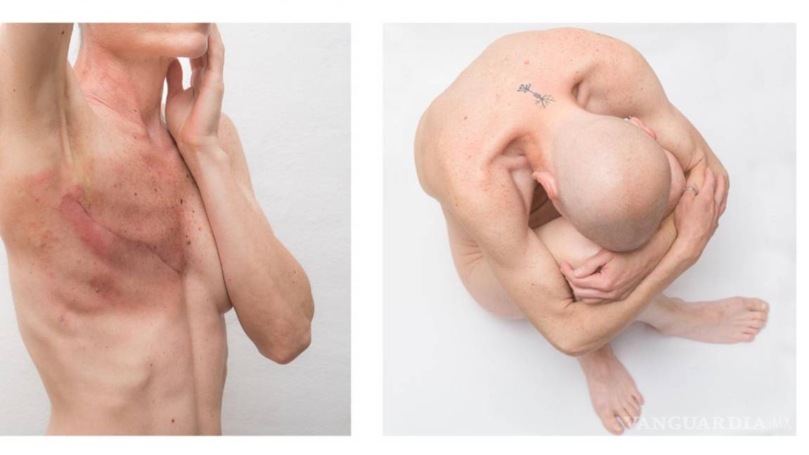 $!Obra de Ana Grúdine sobre el cáncer de mama.