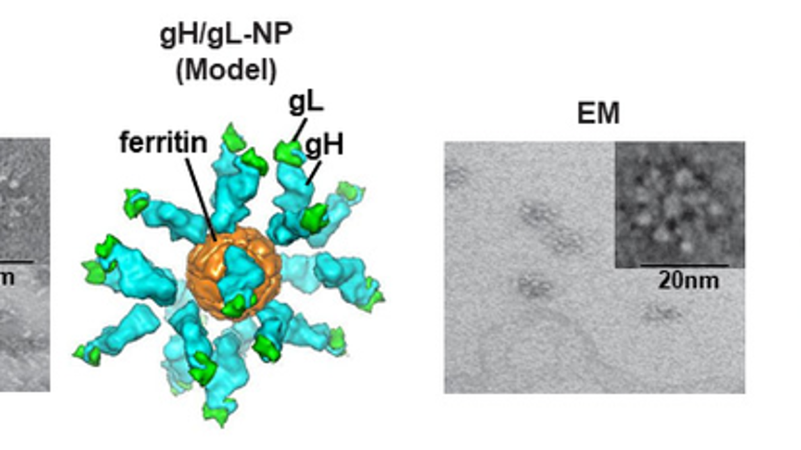 $!Las vacunas de nanopartículas para el virus EpsteinBarr inducen respuestas inmunitarias en animales grandes y provocan anticuerpos que los protegen.