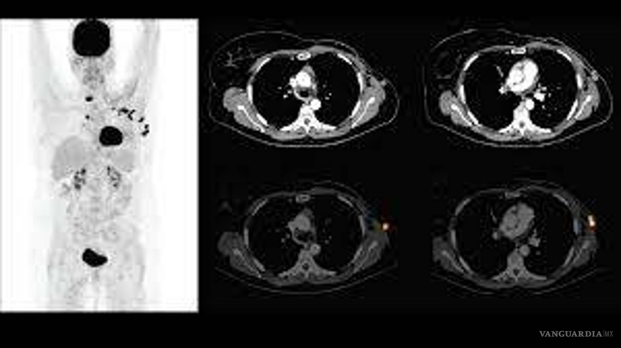 $!El calvario del cáncer en una pandemia, mujeres comparten su testimonio de lucha
