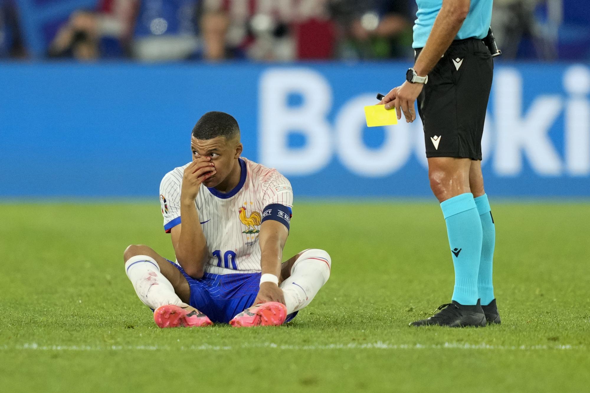 $!Lo que más se ha hablado en el torno de Francia y su máxima figura, Kylian Mbappé, es la rotura de nariz que tuvo el atacante galo en su primer juego.