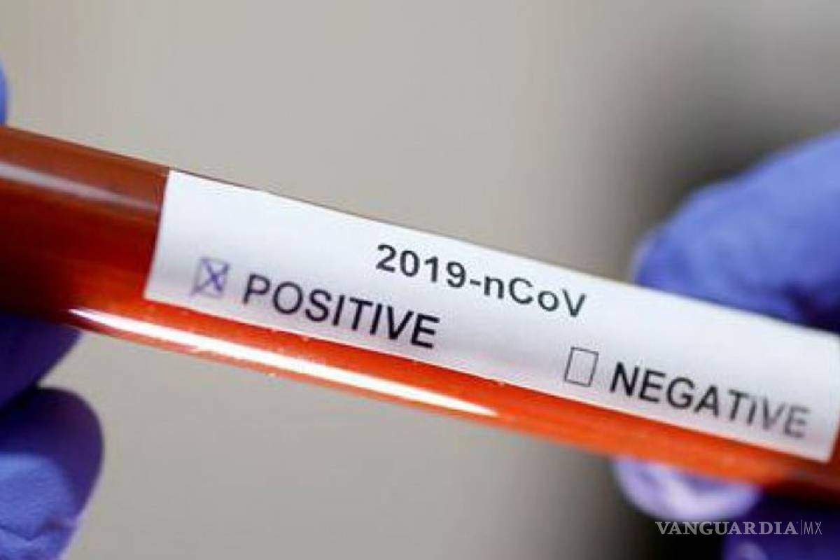 Estos laboratorios pueden hacer pruebas del coronavirus en México