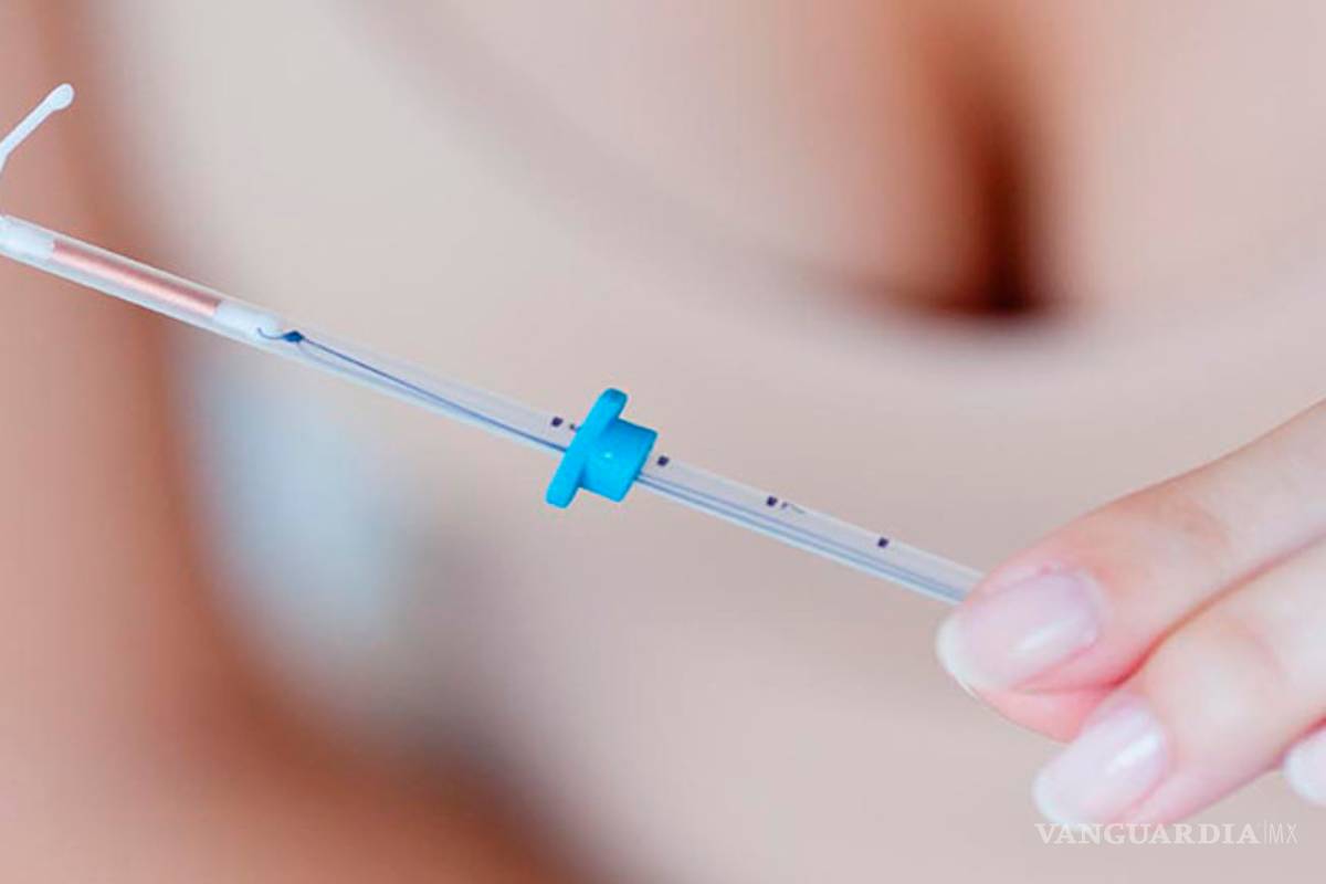 9 cosas que debes saber sobre el DIU (Dispositivo Intrauterino)