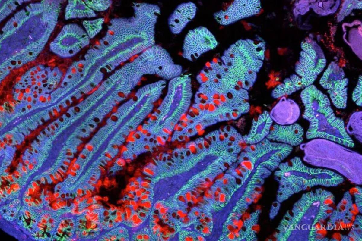 Con la ayuda de la IA crean un mapa celular del pulmón, servirá para comprender enfermedades pulmonares