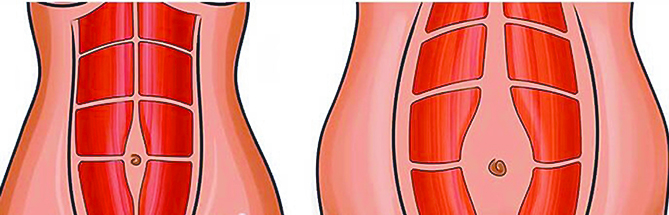 $!Después del parto