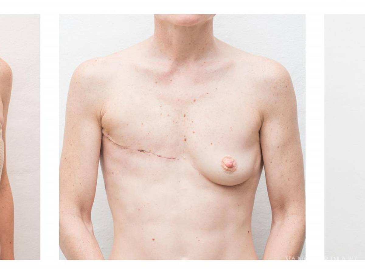 $!Obra de Ana Grúdine sobre el cáncer de mama.