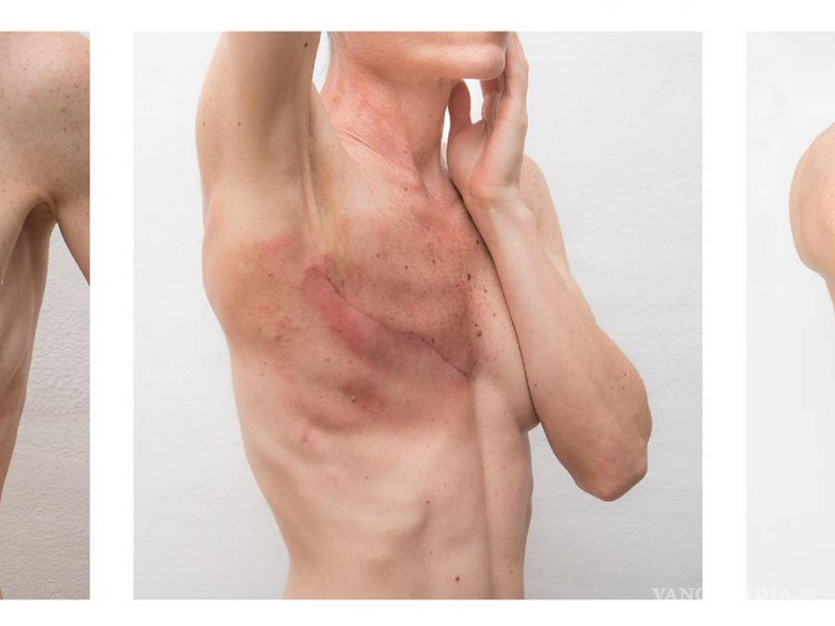 $!Obra de Ana Grúdine sobre el cáncer de mama.