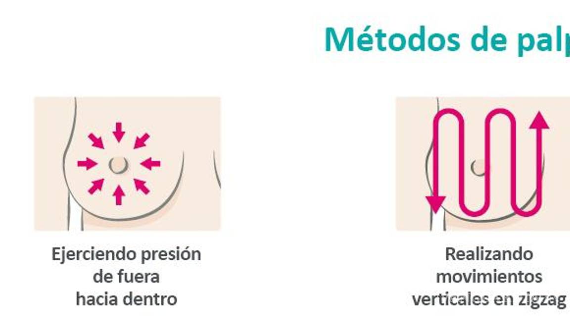 $!¿Cómo hacerse un autoexamen de exploración para detectar el cáncer de mama?