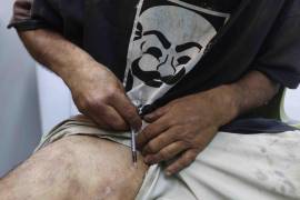 En México se han registrado 168 hospitalizaciones por intoxicación con fentanilo en los últimos tres años, es decir, un promedio de cinco al mes.