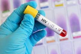 Contagios. La mayoría de los nuevos contagios de VIH detectados es en varones (28).