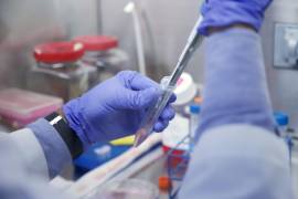 (IMAGEN ILUSTRATIVA) Luego de que tuvo que cancelar licitación plurianuales más grandes de su historia, para banco de sangre; ahora, el IMSS tramita un concurso para el servicio de laboratorio de análisis clínicos.