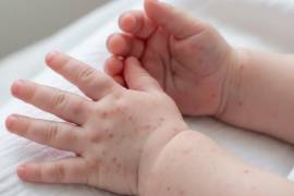 Piden vacunarse a quienes viajan con frecuencia o trabajan en entidades con altas tasas de infección.