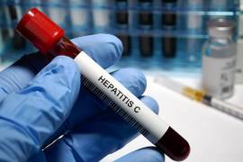 México impulsa el primer programa nacional de eliminación de la hepatitis C en América
