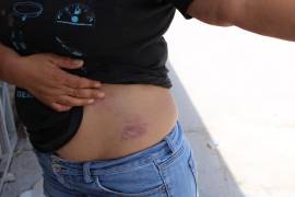 Habitantes de San Pedro mostraron las heridas que sufrieron tras la reyerta con policías.