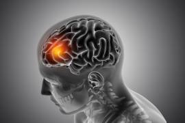 El control médico periódico permite identificar oportunamente alteraciones que elevan el riesgo de un evento cerebrovascular.