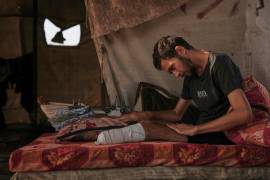 Yassin Marouf, de 23 años, quien perdió el pie izquierdo y sufrió una grave lesión en la pierna derecha tras ser impactado por un bombardeo israelí en mayo, está en una tienda de campaña en Zawaida, Gaza.