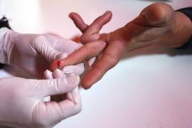 178 mil 310 mexicanos viven con VIH y Sida
