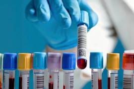 Trasplante de células madre logra eliminar el VIH en seis pacientes