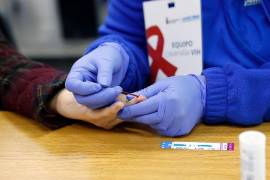 Los casos de VIH en la entidad se han disparado drásticamente en más de mil por ciento.