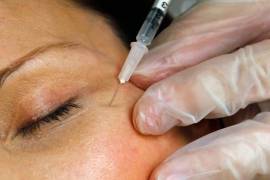 Una paciente recibe una inyección de Botox en una clínica de Arlington, Virginia, el 5 de junio de 2009.