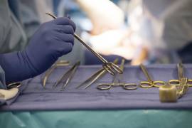 Instrumentos quirúrgicos son utilizados durante un trasplante de órganos en un hospital en Washington el 28 de junio del 2016.