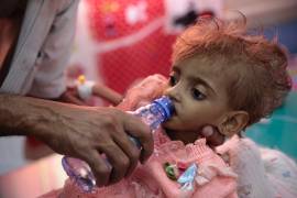 Según Save the Children, el hambre habría matado a 85 mil niños en Yemen