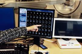 Imágenes de tomografía por emisión de positrones del cerebro de un paciente con Alzheimer en el Hospital General de Massachusetts en Boston