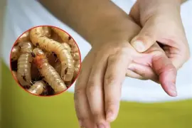 La Secretaría de Salud de Coahuila mantiene un estado de alerta ante la presencia del gusano barrenador en diversos municipios de la entidad, aunque hasta el momento no se han registrado casos en humanos.