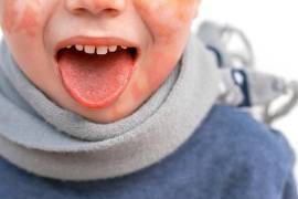 La conmemoración también busca reforzar que el tratamiento oportuno reduce de manera significativa el riesgo de complicaciones cardiacas.